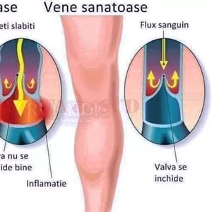 GAMBIERE (șosete cu turmalina) CU TURMALINĂ